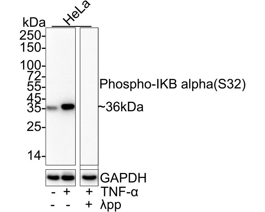 Phospho-IKB alpha (S32) Recombinant Rabbit Monoclonal Antibody [ST53-05]