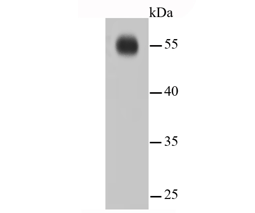 Western blot analysis of IRF7 on hybrid fish (crucian-carp) brain tissue lysates. Proteins were transferred to a PVDF membrane and blocked with 5% BSA in PBS for 1 hour at room temperature. The primary antibody (<a href="/products/ET1610-89" style="font-weight: bold;text-decoration: underline;">ET1610-89</a>, 1/500) was used in 5% BSA at room temperature for 2 hours. Goat Anti-Rabbit IgG - HRP Secondary Antibody (<a href="/products/HA1001" style="font-weight: bold;text-decoration: underline;">HA1001</a>) at 1:5,000 dilution was used for 1 hour at room temperature.