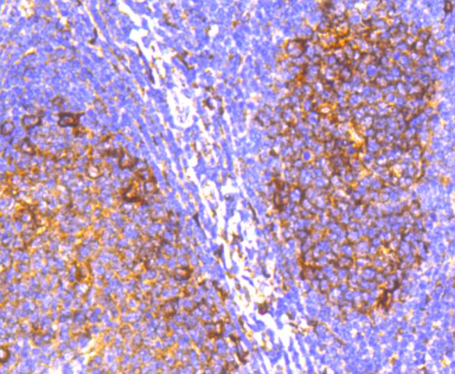 Immunohistochemical analysis of paraffin-embedded human tonsil tissue using anti-IRF7 antibody. The section was pre-treated using heat mediated antigen retrieval with Tris-EDTA buffer (pH 8.0-8.4) for 20 minutes.The tissues were blocked in 5% BSA for 30 minutes at room temperature, washed with ddH<sub>2</sub>O and PBS, and then probed with the primary antibody (<a href="/products/ET1610-89" style="font-weight: bold;text-decoration: underline;">ET1610-89</a>, 1/50) for 30 minutes at room temperature. The detection was performed using an HRP conjugated compact polymer system. DAB was used as the chromogen. Tissues were counterstained with hematoxylin and mounted with DPX.