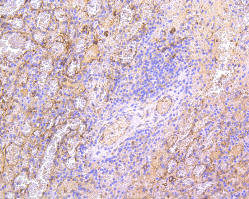 Immunohistochemical analysis of paraffin-embedded human spleen tissue using anti-IRF7 antibody. The section was pre-treated using heat mediated antigen retrieval with Tris-EDTA buffer (pH 8.0-8.4) for 20 minutes.The tissues were blocked in 5% BSA for 30 minutes at room temperature, washed with ddH<sub>2</sub>O and PBS, and then probed with the primary antibody (<a href="/products/ET1610-89" style="font-weight: bold;text-decoration: underline;">ET1610-89</a>, 1/50) for 30 minutes at room temperature. The detection was performed using an HRP conjugated compact polymer system. DAB was used as the chromogen. Tissues were counterstained with hematoxylin and mounted with DPX.