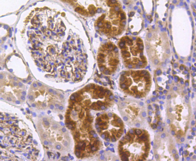 Immunohistochemical analysis of paraffin-embedded human kidney tissue using anti-IRF7 antibody. The section was pre-treated using heat mediated antigen retrieval with Tris-EDTA buffer (pH 8.0-8.4) for 20 minutes.The tissues were blocked in 5% BSA for 30 minutes at room temperature, washed with ddH<sub>2</sub>O and PBS, and then probed with the primary antibody (<a href="/products/ET1610-89" style="font-weight: bold;text-decoration: underline;">ET1610-89</a>, 1/50) for 30 minutes at room temperature. The detection was performed using an HRP conjugated compact polymer system. DAB was used as the chromogen. Tissues were counterstained with hematoxylin and mounted with DPX.