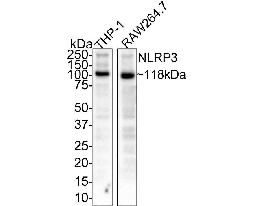 Western blot analysis of NLRP3 on different lysates with Rabbit anti-NLRP3 antibody (<a href="/products/ET1610-93" style="font-weight: bold;text-decoration: underline;">ET1610-93</a>) at 1/1,000 dilution.<br /><br />Lane 1: THP-1 cell lysate<br />Lane 2: RAW264.7 cell lysate<br /><br />Lysates/proteins at 20 µg/Lane.<br /><br />Predicted band size: 118 kDa<br />Observed band size: 118 kDa<br /><br />Exposure time: 3 minutes;<br /><br />4-20% SDS-PAGE gel.<br /><br />Proteins were transferred to a PVDF membrane and blocked with 5% NFDM/TBST for 1 hour at room temperature. The primary antibody (<a href="/products/ET1610-93" style="font-weight: bold;text-decoration: underline;">ET1610-93</a>) at 1/1,000 dilution was used in 5% NFDM/TBST at room temperature for 2 hours. Goat Anti-Rabbit IgG - HRP Secondary Antibody (<a href="/products/HA1001" style="font-weight: bold;text-decoration: underline;">HA1001</a>) at 1:100,000 dilution was used for 1 hour at room temperature.
