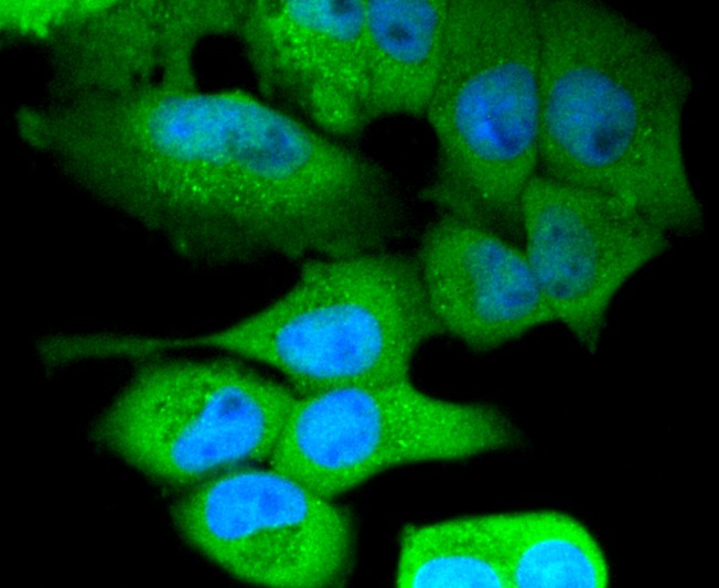 ICC staining of NLRP3 in Hela cells (green). Formalin fixed cells were permeabilized with 0.1% Triton X-100 in TBS for 10 minutes at room temperature and blocked with 1% Blocker BSA for 15 minutes at room temperature. Cells were probed with the primary antibody (<a href="/products/ET1610-93" style="font-weight: bold;text-decoration: underline;">ET1610-93</a>, 1/50) for 1 hour at room temperature, washed with PBS. Alexa Fluor&reg;488 Goat anti-Rabbit IgG was used as the secondary antibody at 1/1,000 dilution. The nuclear counter stain is DAPI (blue).