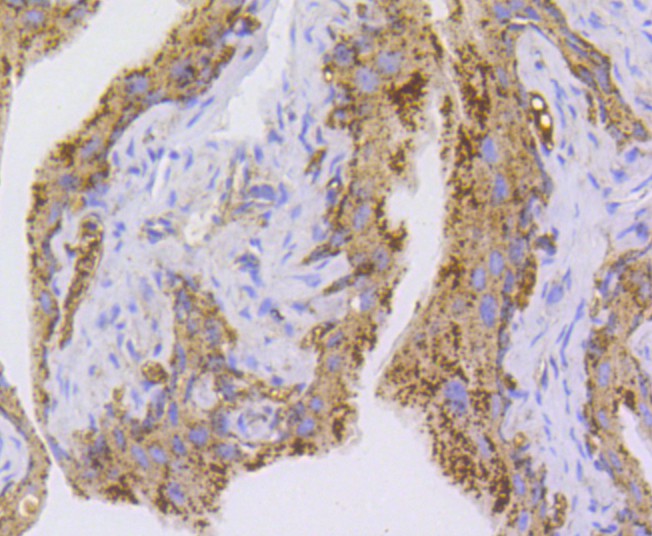 Immunohistochemical analysis of paraffin-embedded mouse bladder tissue using anti-NLRP3 antibody. The section was pre-treated using heat mediated antigen retrieval with Tris-EDTA buffer (pH 9.0) for 20 minutes.The tissues were blocked in 1% BSA for 30 minutes at room temperature, washed with ddH<sub>2</sub>O and PBS, and then probed with the primary antibody (<a href="/products/ET1610-93" style="font-weight: bold;text-decoration: underline;">ET1610-93</a>, 1/50) for 30 minutes at room temperature. The detection was performed using an HRP conjugated compact polymer system. DAB was used as the chromogen. Tissues were counterstained with hematoxylin and mounted with DPX.