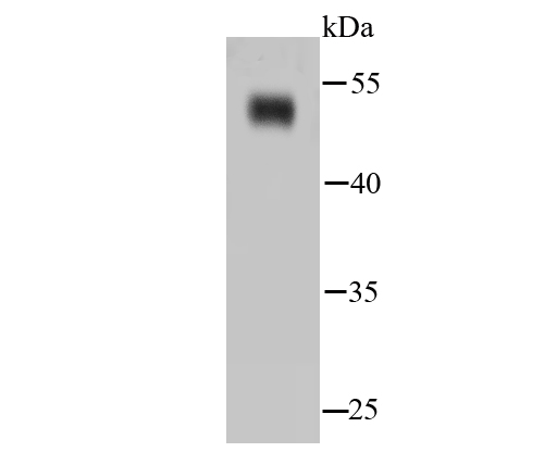 Western blot analysis of NSE on hybrid fish<br />(crucian-carp) brain tissue lysates. Proteins were transferred to a PVDF membrane and blocked with 5% BSA in PBS for 1 hour at room temperature. The primary antibody (<a href="/products/ET1610-96" style="font-weight: bold;text-decoration: underline;">ET1610-96</a>, 1/500) was used in 5% BSA at room temperature for 2 hours. Goat Anti-Rabbit IgG - HRP Secondary Antibody (<a href="/products/HA1001" style="font-weight: bold;text-decoration: underline;">HA1001</a>) at 1:5,000 dilution was used for 1 hour at room temperature.