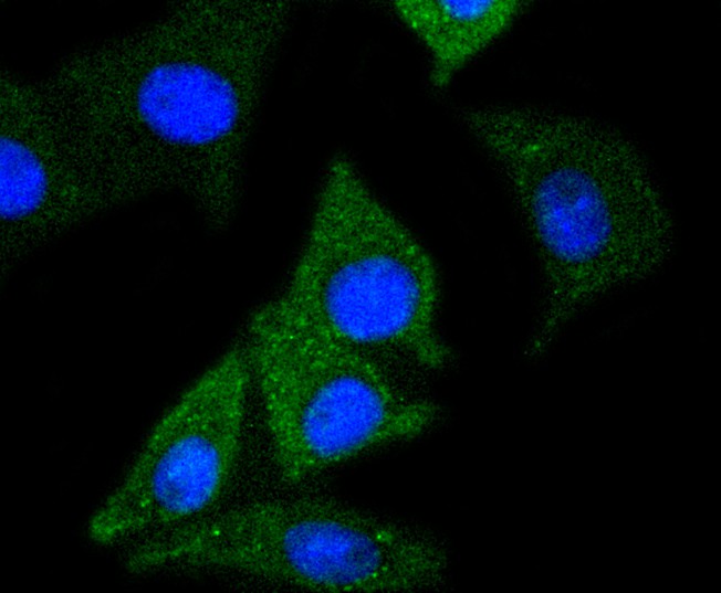 ICC staining of NSE in SH-SY5Y cells (green). Formalin fixed cells were permeabilized with 0.1% Triton X-100 in TBS for 10 minutes at room temperature and blocked with 1% Blocker BSA for 15 minutes at room temperature. Cells were probed with the primary antibody (<a href="/products/ET1610-96" style="font-weight: bold;text-decoration: underline;">ET1610-96</a>, 1/50) for 1 hour at room temperature, washed with PBS. Alexa Fluor&reg;488 Goat anti-Rabbit IgG was used as the secondary antibody at 1/1,000 dilution. The nuclear counter stain is DAPI (blue).