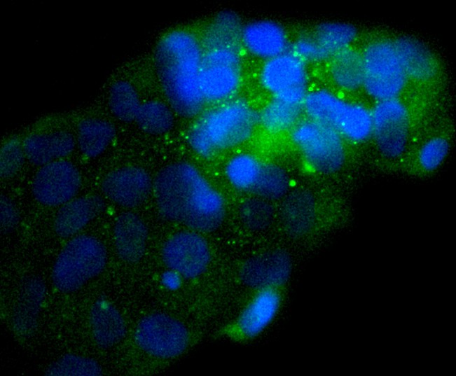 ICC staining of NSE in 293 cells (green). Formalin fixed cells were permeabilized with 0.1% Triton X-100 in TBS for 10 minutes at room temperature and blocked with 1% Blocker BSA for 15 minutes at room temperature. Cells were probed with the primary antibody (<a href="/products/ET1610-96" style="font-weight: bold;text-decoration: underline;">ET1610-96</a>, 1/50) for 1 hour at room temperature, washed with PBS. Alexa Fluor&reg;488 Goat anti-Rabbit IgG was used as the secondary antibody at 1/1,000 dilution. The nuclear counter stain is DAPI (blue).