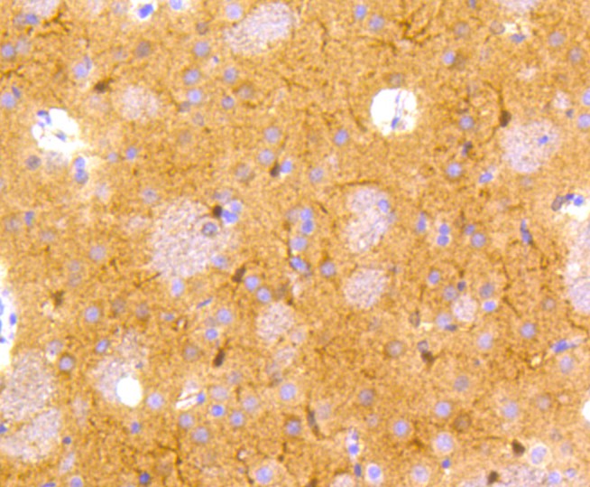 Immunohistochemical analysis of paraffin-embedded rat brain tissue using anti-NSE antibody. The section was pre-treated using heat mediated antigen retrieval with Tris-EDTA buffer (pH 8.0-8.4) for 20 minutes.The tissues were blocked in 5% BSA for 30 minutes at room temperature, washed with ddH<sub>2</sub>O and PBS, and then probed with the primary antibody (<a href="/products/ET1610-96" style="font-weight: bold;text-decoration: underline;">ET1610-96</a>, 1/50) for 30 minutes at room temperature. The detection was performed using an HRP conjugated compact polymer system. DAB was used as the chromogen. Tissues were counterstained with hematoxylin and mounted with DPX.