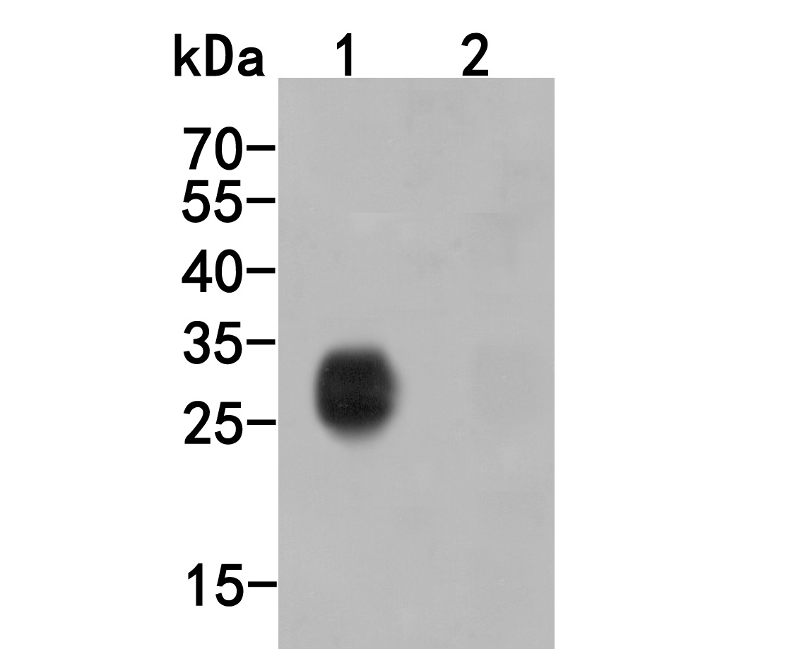 Western blot analysis of HA tag on different lysates. Proteins were transferred to a PVDF membrane and blocked with 5% BSA in PBS for 1 hour at room temperature. The primary antibody (<a href="/products/ET1611-49" style="font-weight: bold;text-decoration: underline;">ET1611-49</a>, 1/2,000) was used in 5% BSA at room temperature for 2 hours. Goat Anti-Rabbit IgG - HRP Secondary Antibody (<a href="/products/HA1001" style="font-weight: bold;text-decoration: underline;">HA1001</a>) at 1:5,000 dilution was used for 1 hour at room temperature.<br />Positive control: <br />Lane 1: C-terminal HA-tagged recombinant protein<br />Lane 2: N-terminal HA-tagged recombinant protein