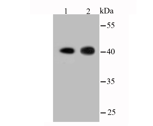 Western blot analysis of Actin on different lysates. Proteins were transferred to a PVDF membrane and blocked with 5% BSA in PBS for 1 hour at room temperature. The primary antibody (<a href="/products/ET1701-80" style="font-weight: bold;text-decoration: underline;">ET1701-80</a>, 1/500) was used in 5% BSA at room temperature for 2 hours. Goat Anti-Rabbit IgG - HRP Secondary Antibody (<a href="/products/HA1001" style="font-weight: bold;text-decoration: underline;">HA1001</a>) at 1:5,000 dilution was used for 1 hour at room temperature.<br />Positive control:<br />Lane 1: Hybrid  fish (crucian-carp) brain tissue lysate<br />Lane 2: Hybrid fish (crucian-carp) kidney tissue lysate