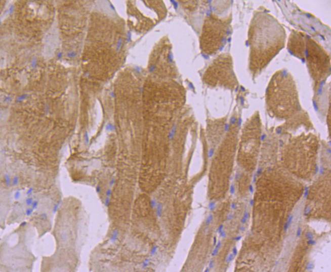Immunohistochemical analysis of paraffin-embedded mouse cardiac muscle tissue using anti-Actin antibody. The section was pre-treated using heat mediated antigen retrieval with Tris-EDTA buffer (pH 8.0-8.4) for 20 minutes.The tissues were blocked in 5% BSA for 30 minutes at room temperature, washed with ddH<sub>2</sub>O and PBS, and then probed with the primary antibody (<a href="/products/ET1701-80" style="font-weight: bold;text-decoration: underline;">ET1701-80</a>, 1/50) for 30 minutes at room temperature. The detection was performed using an HRP conjugated compact polymer system. DAB was used as the chromogen. Tissues were counterstained with hematoxylin and mounted with DPX.