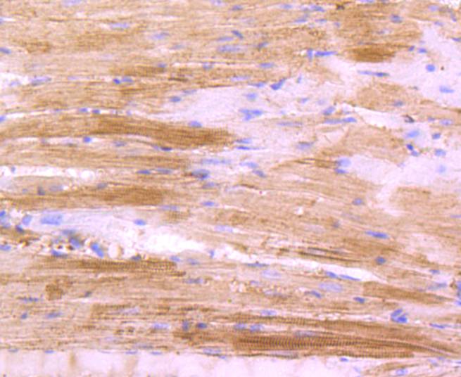 Immunohistochemical analysis of paraffin-embedded mouse smooth muscle tissue using anti-Actin antibody. The section was pre-treated using heat mediated antigen retrieval with Tris-EDTA buffer (pH 8.0-8.4) for 20 minutes.The tissues were blocked in 5% BSA for 30 minutes at room temperature, washed with ddH<sub>2</sub>O and PBS, and then probed with the primary antibody (<a href="/products/ET1701-80" style="font-weight: bold;text-decoration: underline;">ET1701-80</a>, 1/50) for 30 minutes at room temperature. The detection was performed using an HRP conjugated compact polymer system. DAB was used as the chromogen. Tissues were counterstained with hematoxylin and mounted with DPX.