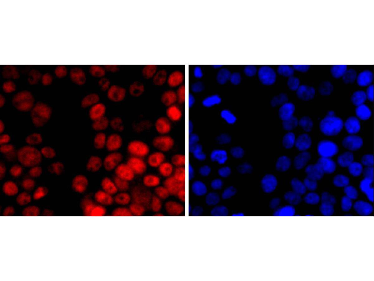 ICC staining of Dnmt1 in HepG2 cells (red). Formalin fixed cells were permeabilized with 0.1% Triton X-100 in TBS for 10 minutes at room temperature and blocked with 1% Blocker BSA for 15 minutes at room temperature. Cells were probed with the primary antibody (<a href="/products/ET1702-77" style="font-weight: bold;text-decoration: underline;">ET1702-77</a>, 1/50) for 1 hour at room temperature, washed with PBS. Alexa Fluor&reg;594 Goat anti-Rabbit IgG was used as the secondary antibody at 1/1,000 dilution. The nuclear counter stain is DAPI (blue).