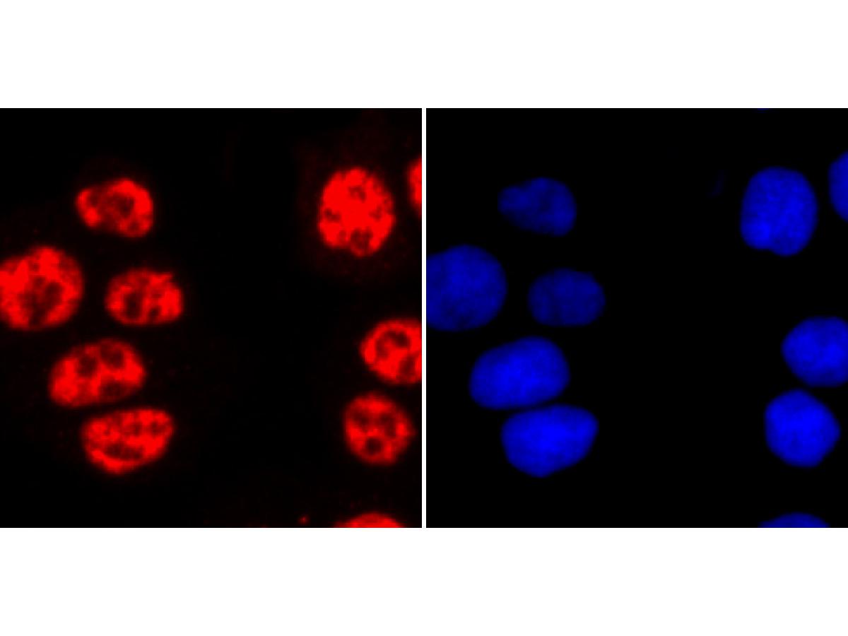 ICC staining of Phospho-POLR2A (S2) in Hela cells (red). Formalin fixed cells were permeabilized with 0.1% Triton X-100 in TBS for 10 minutes at room temperature and blocked with 10% negative goat serum for 15 minutes at room temperature. Cells were probed with the primary antibody (<a href="/products/ET1703-86" style="font-weight: bold;text-decoration: underline;">ET1703-86</a>, 1/50) for 1 hour at room temperature, washed with PBS. Alexa Fluor&reg;594 conjugate-Goat anti-Rabbit IgG was used as the secondary antibody at 1/1,000 dilution. The nuclear counter stain is DAPI (blue).