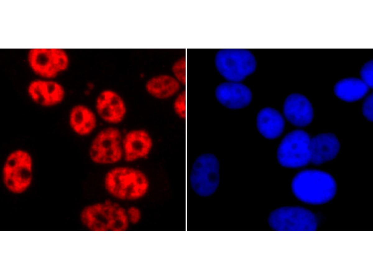 ICC staining of Phospho-POLR2A (S2) in MCF-7 cells (red). Formalin fixed cells were permeabilized with 0.1% Triton X-100 in TBS for 10 minutes at room temperature and blocked with 10% negative goat serum for 15 minutes at room temperature. Cells were probed with the primary antibody (<a href="/products/ET1703-86" style="font-weight: bold;text-decoration: underline;">ET1703-86</a>, 1/50) for 1 hour at room temperature, washed with PBS. Alexa Fluor&reg;594 conjugate-Goat anti-Rabbit IgG was used as the secondary antibody at 1/1,000 dilution. The nuclear counter stain is DAPI (blue).