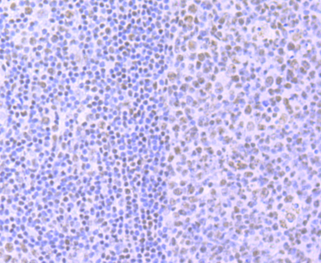 Immunohistochemical analysis of paraffin-embedded human tonsil tissue using anti-Phospho-POLR2A (S2) antibody. The section was pre-treated using heat mediated antigen retrieval with sodium citrate buffer (pH 6.0) for 20 minutes. The tissues were blocked in 1% BSA for 30 minutes at room temperature, washed with ddH<sub>2</sub>O and PBS, and then probed with the primary antibody (<a href="/products/ET1703-86" style="font-weight: bold;text-decoration: underline;">ET1703-86</a>, 1/50)  for 30 minutes at room temperature. The detection was performed using an HRP conjugated compact polymer system. DAB was used as the chromogen. Tissues were counterstained with hematoxylin and mounted with DPX.