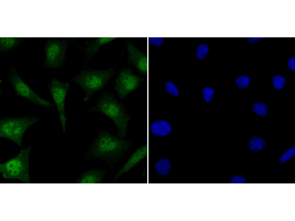 Immunocytochemistry analysis of SH-SY-5Y cells labeling KAT8 with Rabbit anti-KAT8 antibody (<a href="/products/ET7108-23" style="font-weight: bold;text-decoration: underline;">ET7108-23</a>) at 1/50 dilution.<br /><br />Cells were fixed in 4% paraformaldehyde for 10 minutes at 37 ℃, permeabilized with 0.05% Triton X-100 in PBS for 20 minutes, and then blocked with 2% negative goat serum for 30 minutes at room temperature. Cells were then incubated with Rabbit anti-KAT8 antibody (<a href="/products/ET7108-23" style="font-weight: bold;text-decoration: underline;">ET7108-23</a>) at 1/50 dilution in 2% negative goat serum overnight at 4 ℃.Alexa Fluor&reg;488 Goat anti-Rabbit IgG  was used as the secondary antibody at 1/1,000 dilution.  Nuclear DNA was labelled in blue with DAPI.