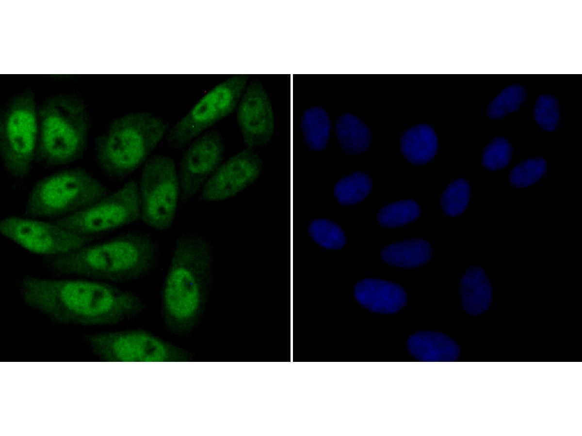 Immunocytochemistry analysis of SiHa cells labeling KAT8 with Rabbit anti-KAT8 antibody (<a href="/products/ET7108-23" style="font-weight: bold;text-decoration: underline;">ET7108-23</a>) at 1/50 dilution.<br /><br />Cells were fixed in 4% paraformaldehyde for 10 minutes at 37 ℃, permeabilized with 0.05% Triton X-100 in PBS for 20 minutes, and then blocked with 2% negative goat serum for 30 minutes at room temperature. Cells were then incubated with Rabbit anti-KAT8 antibody (<a href="/products/ET7108-23" style="font-weight: bold;text-decoration: underline;">ET7108-23</a>) at 1/50 dilution in 2% negative goat serum overnight at 4 ℃.Alexa Fluor&reg;488 Goat anti-Rabbit IgG  was used as the secondary antibody at 1/1,000 dilution. Nuclear DNA was labelled in blue with DAPI.