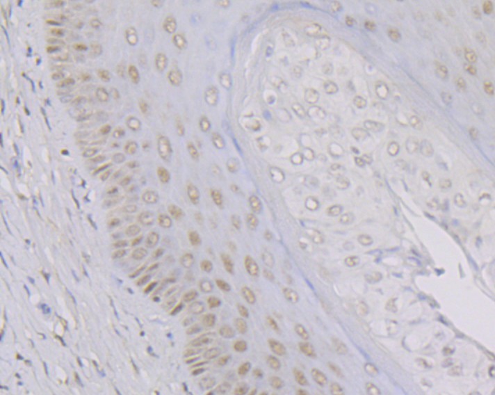 Immunohistochemical analysis of paraffin-embedded rat cervix tissue with Rabbit anti-KAT8 antibody (<a href="/products/ET7108-23" style="font-weight: bold;text-decoration: underline;">ET7108-23</a>) at 1/50 dilution.<br /><br />The section was pre-treated using heat mediated antigen retrieval with sodium citrate buffer (pH 6.0) for 2 minutes. The tissues were blocked in 1% BSA for 20 minutes at room temperature, washed with ddH<sub>2</sub>O and PBS, and then probed with the primary antibody (<a href="/products/ET7108-23" style="font-weight: bold;text-decoration: underline;">ET7108-23</a>) at 1/50 dilution for 1 hour at room temperature. The detection was performed using an HRP conjugated compact polymer system. DAB was used as the chromogen. Tissues were counterstained with hematoxylin and mounted with DPX.