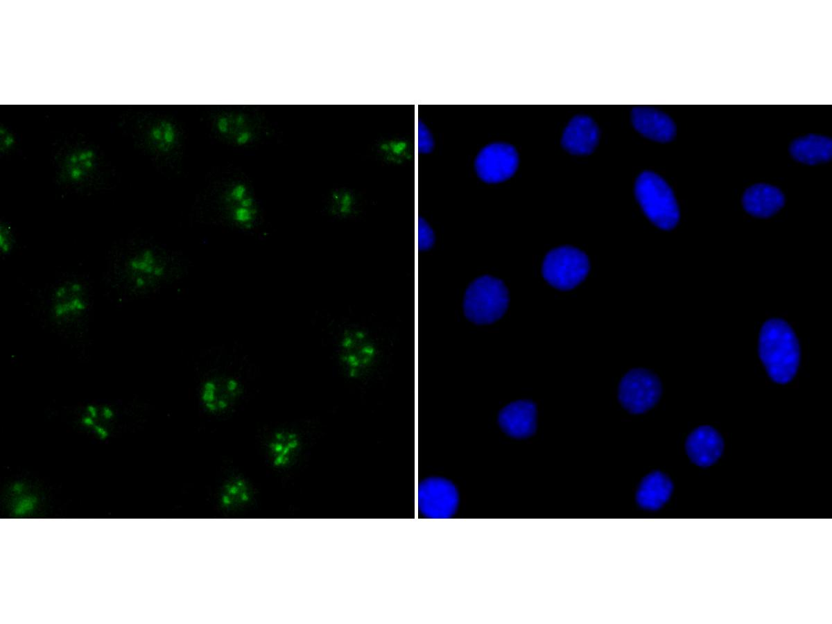 Immunocytochemistry analysis of SH-SY5Y cells labeling CENPC with Rabbit anti-CENPC antibody (<a href="/products/ET7108-24" style="font-weight: bold;text-decoration: underline;">ET7108-24</a>) at 1/50 dilution.<br /><br />Cells were fixed in 4% paraformaldehyde for 10 minutes at 37 ℃, permeabilized with 0.05% Triton X-100 in PBS for 20 minutes, and then blocked with 2% negative goat serum for 30 minutes at room temperature. Cells were then incubated with Rabbit anti-CENPC antibody (<a href="/products/ET7108-24" style="font-weight: bold;text-decoration: underline;">ET7108-24</a>) at 1/50 dilution in 2% negative goat serum overnight at 4 ℃.Alexa Fluor&reg;488 Goat anti-Rabbit IgG  was used as the secondary antibody at 1/1,000 dilution. Nuclear DNA was labelled in blue with DAPI.