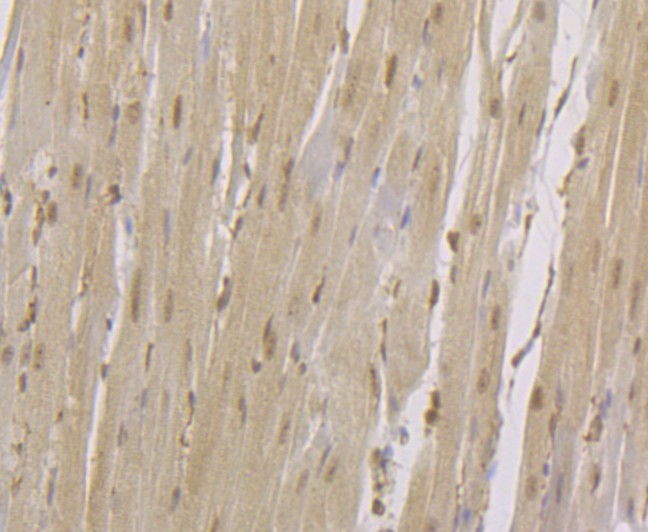 Immunohistochemical analysis of paraffin-embedded  rat heart tissue with Rabbit anti-CENPC antibody (<a href="/products/ET7108-24" style="font-weight: bold;text-decoration: underline;">ET7108-24</a>) at 1/50 dilution.<br /><br />The section was pre-treated using heat mediated antigen retrieval with Tris-EDTA buffer (pH 8.0-8.4)) for 20 minutes. The tissues were blocked in 1% BSA for 20 minutes at room temperature, washed with ddH<sub>2</sub>O and PBS, and then probed with the primary antibody (<a href="/products/ET7108-24" style="font-weight: bold;text-decoration: underline;">ET7108-24</a>) at 1/50 dilution for 0.5 hour at room temperature. The detection was performed using an HRP conjugated compact polymer system. DAB was used as the chromogen. Tissues were counterstained with hematoxylin and mounted with DPX.
