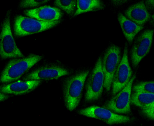 Immunocytochemistry analysis of SiHa cells labeling UQCRFS1 with Rabbit anti-UQCRFS1 antibody (<a href="/products/ET7108-28" style="font-weight: bold;text-decoration: underline;">ET7108-28</a>) at 1/50 dilution.<br /><br />Cells were fixed in 4% paraformaldehyde for 10 minutes at 37 ℃, permeabilized with 0.05% Triton X-100 in PBS for 20 minutes, and then blocked with 2% negative goat serum for 30 minutes at room temperature. Cells were then incubated with Rabbit anti-UQCRFS1 antibody (<a href="/products/ET7108-28" style="font-weight: bold;text-decoration: underline;">ET7108-28</a>) at 1/50 dilution in 2% negative goat serum overnight at 4 ℃.Alexa Fluor&reg;488 Goat anti-Rabbit IgG  was used as the secondary antibody at 1/1,000 dilution. Nuclear DNA was labelled in blue with DAPI.