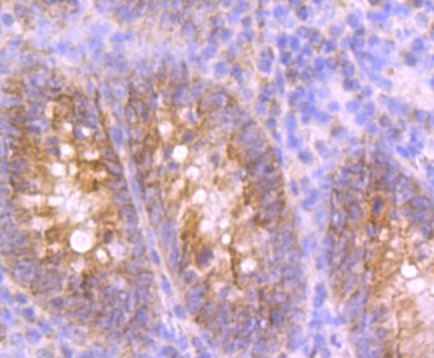 Immunohistochemical analysis of paraffin-embedded human appendix tissue with Rabbit anti-UQCRFS1 antibody (<a href="/products/ET7108-28" style="font-weight: bold;text-decoration: underline;">ET7108-28</a>) at 1/50 dilution.<br /><br />The section was pre-treated using heat mediated antigen retrieval with Tris-EDTA buffer (pH 9.0) for 20 minutes. The tissues were blocked in 1% BSA for 20 minutes at room temperature, washed with ddH<sub>2</sub>O and PBS, and then probed with the primary antibody (<a href="/products/ET7108-28" style="font-weight: bold;text-decoration: underline;">ET7108-28</a>) at 1/50 dilution for 0.5 hour at room temperature. The detection was performed using an HRP conjugated compact polymer system. DAB was used as the chromogen. Tissues were counterstained with hematoxylin and mounted with DPX.