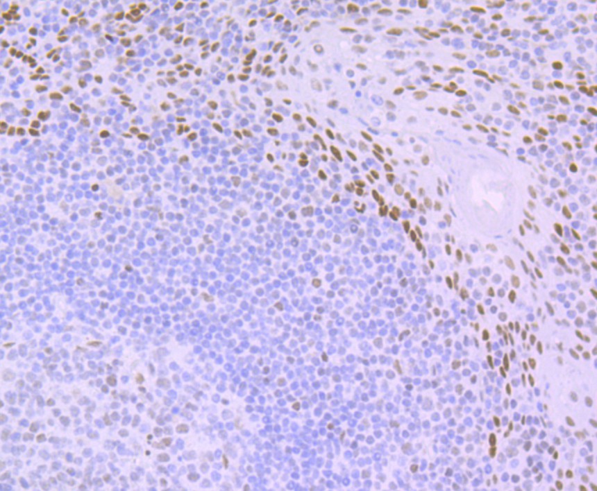 Immunohistochemical analysis of paraffin-embedded human tonsil tissue using anti-DDB2 antibody. Counter stained with hematoxylin.