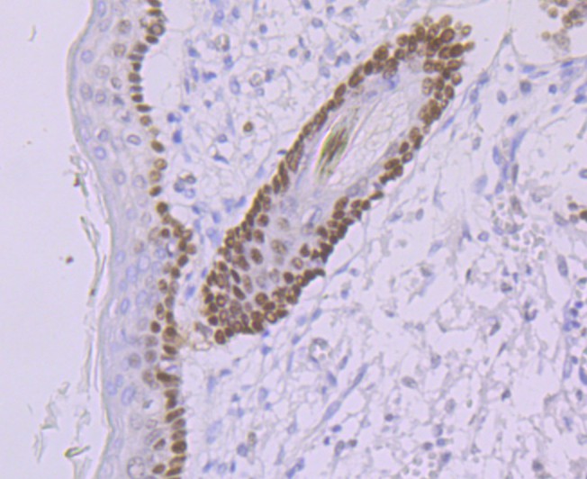 Immunohistochemical analysis of paraffin-embedded human skin tissue using anti-DDB2 antibody. Counter stained with hematoxylin.