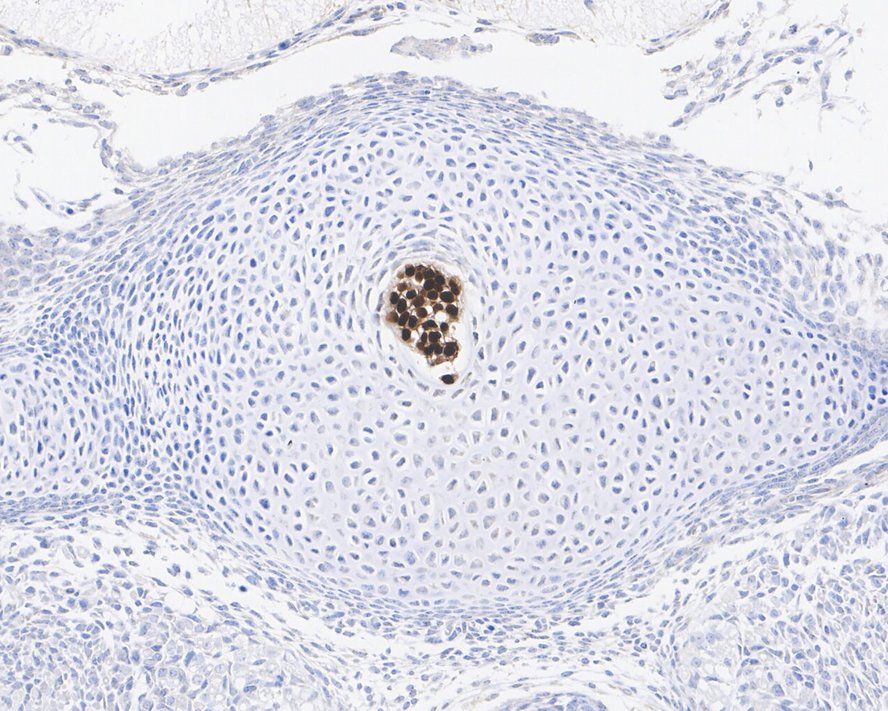 Immunohistochemical analysis of paraffin-embedded mouse embryo notochord tissue with Rabbit anti-Brachyury / Bry antibody (<a href="/products/ET7109-35" style="font-weight: bold;text-decoration: underline;">ET7109-35</a>) at 1/1,000 dilution.<br /><br />The section was pre-treated using heat mediated antigen retrieval with sodium citrate buffer (pH 6.0) for 2 minutes. The tissues were blocked in 1% BSA for 20 minutes at room temperature, washed with ddH<sub>2</sub>O and PBS, and then probed with the primary antibody (<a href="/products/ET7109-35" style="font-weight: bold;text-decoration: underline;">ET7109-35</a>) at 1/1,000 dilution for 1 hour at room temperature. The detection was performed using an HRP conjugated compact polymer system. DAB was used as the chromogen. Tissues were counterstained with hematoxylin and mounted with DPX.