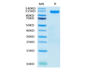 Human Siglec2/CD22 Protein