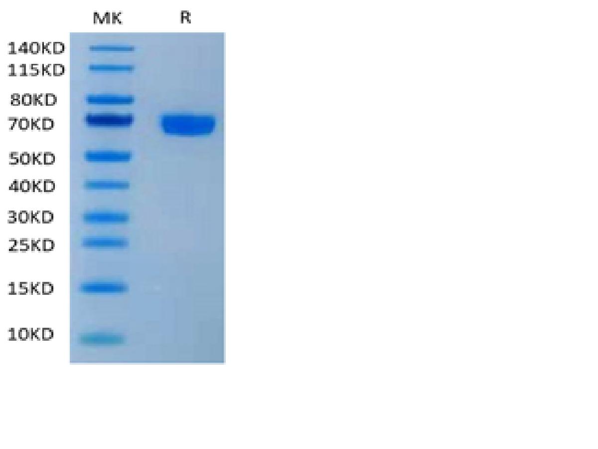 Human PD-1/PDCD1 Protein