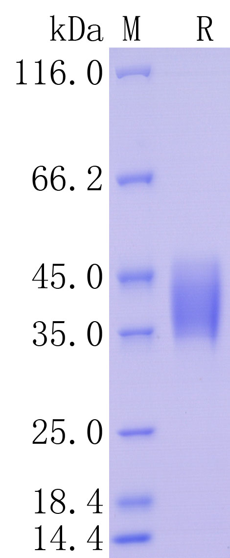 Human IFN-gamma R1, C-His Tag (ECD)