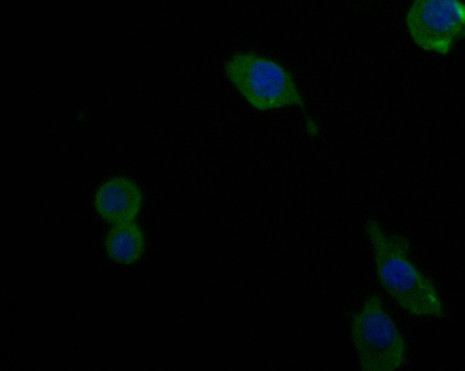 ICC staining of Complement factor B in SKOV-3 cells (green). Formalin fixed cells were permeabilized with 0.1% Triton X-100 in TBS for 10 minutes at room temperature and blocked with 1% Blocker BSA for 15 minutes at room temperature. Cells were probed with the primary antibody (<a href="/products/HA500036" style="font-weight: bold;text-decoration: underline;">HA500036</a>, 1/200) for 1 hour at room temperature, washed with PBS. Alexa Fluor&reg;488 Goat anti-Rabbit IgG was used as the secondary antibody at 1/1,000 dilution. The nuclear counter stain is DAPI (blue).