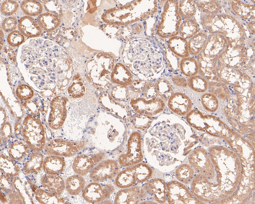 Immunohistochemical analysis of paraffin-embedded rat kidney tissue using anti-SFT antibody. The section was pre-treated using heat mediated antigen retrieval with Tris-EDTA buffer (pH 8.0-8.4) for 20 minutes.The tissues were blocked in 5% BSA for 30 minutes at room temperature, washed with ddH<sub>2</sub>O and PBS, and then probed with the primary antibody (<a href="/products/HA500229" style="font-weight: bold;text-decoration: underline;">HA500229</a>, 1/400) for 30 minutes at room temperature. The detection was performed using an HRP conjugated compact polymer system. DAB was used as the chromogen. Tissues were counterstained with hematoxylin and mounted with DPX.