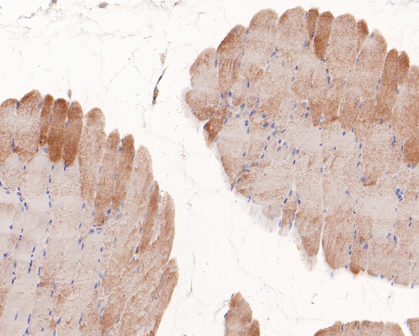 Immunohistochemical analysis of paraffin-embedded mouse skeletal muscle tissue using anti-SFT antibody. The section was pre-treated using heat mediated antigen retrieval with Tris-EDTA buffer (pH 8.0-8.4) for 20 minutes.The tissues were blocked in 5% BSA for 30 minutes at room temperature, washed with ddH<sub>2</sub>O and PBS, and then probed with the primary antibody (<a href="/products/HA500229" style="font-weight: bold;text-decoration: underline;">HA500229</a>, 1/400) for 30 minutes at room temperature. The detection was performed using an HRP conjugated compact polymer system. DAB was used as the chromogen. Tissues were counterstained with hematoxylin and mounted with DPX.