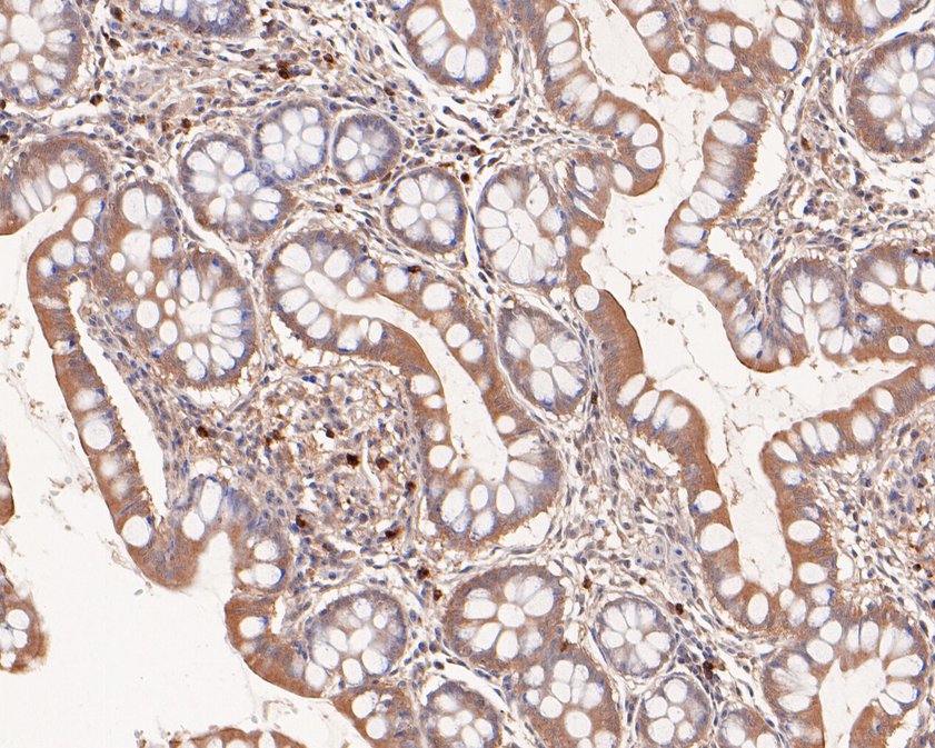 Immunohistochemical analysis of paraffin-embedded human small intestine tissue using anti-RPE antibody. The section was pre-treated using heat mediated antigen retrieval with Tris-EDTA buffer (pH 9.0) for 20 minutes.The tissues were blocked in 5% BSA for 30 minutes at room temperature, washed with ddH<sub>2</sub>O and PBS, and then probed with the primary antibody (<a href="/products/HA500234" style="font-weight: bold;text-decoration: underline;">HA500234</a>, 1/400) for 30 minutes at room temperature. The detection was performed using an HRP conjugated compact polymer system. DAB was used as the chromogen. Tissues were counterstained with hematoxylin and mounted with DPX.