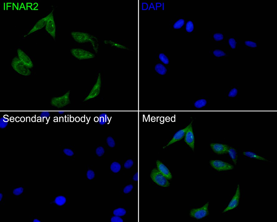 ICC staining of IFNAR2 in SH-SY5Y cells (green). Formalin fixed cells were permeabilized with 0.1% Triton X-100 in TBS for 10 minutes at room temperature and blocked with 10% negative goat serum for 15 minutes at room temperature. Cells were probed with the primary antibody (<a href="/products/HA500284" style="font-weight: bold;text-decoration: underline;">HA500284</a>, 1/200) for 1 hour at room temperature, washed with PBS. Alexa Fluor&reg;488 conjugate-Goat anti-Rabbit IgG was used as the secondary antibody at 1/1,000 dilution. The nuclear counter stain is DAPI (blue).