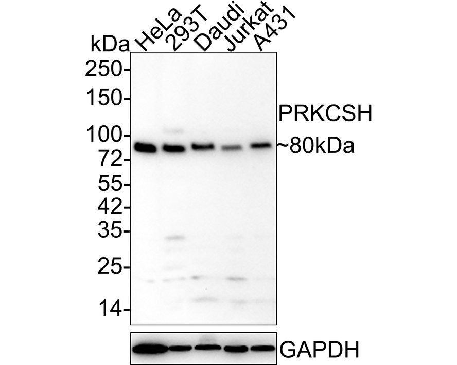 Glucosidase 2 subunit beta Mouse Monoclonal Antibody [A6H9]