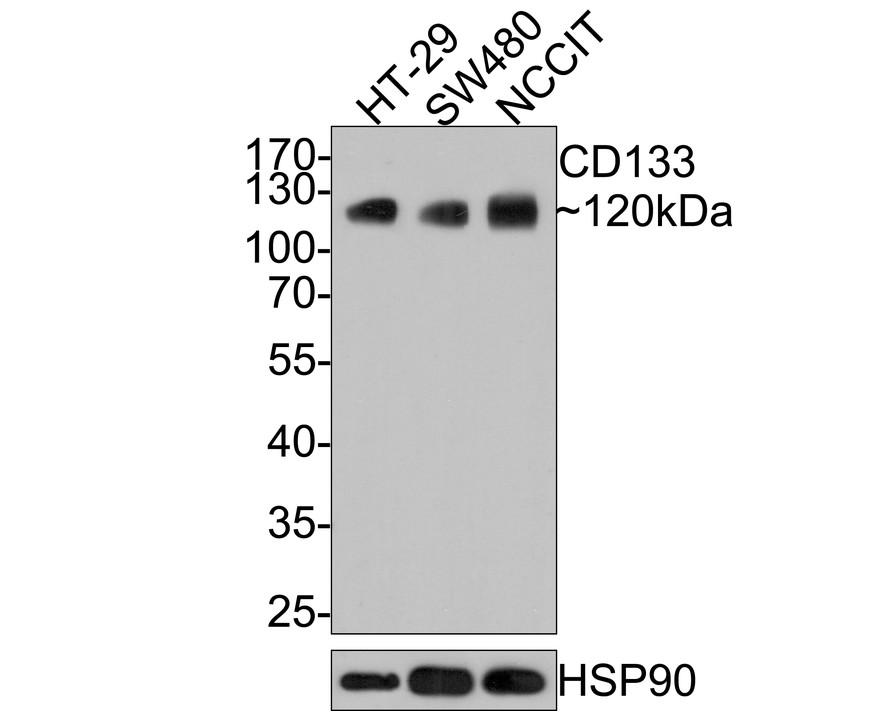 CD133 Recombinant Mouse Monoclonal Antibody [A8C3-R]