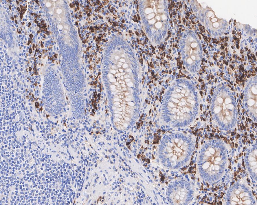Immunohistochemical analysis of paraffin-embedded human appendix tissue with Mouse anti-Kappa Light Chain antibody (<a href="/products/HA601099" style="font-weight: bold;text-decoration: underline;">HA601099</a>) at 1/500 dilution.<br /><br />The section was pre-treated using heat mediated antigen retrieval with Tris-EDTA buffer (pH 9.0) for 20 minutes. The tissues were blocked in 1% BSA for 20 minutes at room temperature, washed with ddH<sub>2</sub>O and PBS, and then probed with the primary antibody (<a href="/products/HA601099" style="font-weight: bold;text-decoration: underline;">HA601099</a>) at 1/500 dilution for 1 hour at room temperature. The detection was performed using an HRP conjugated compact polymer system. DAB was used as the chromogen. Tissues were counterstained with hematoxylin and mounted with DPX.