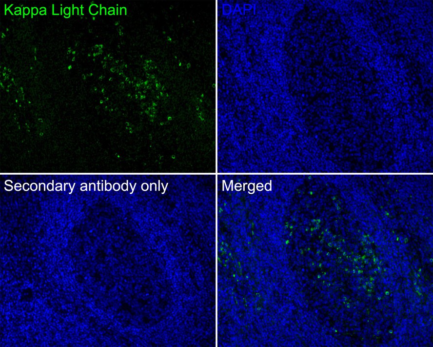 Immunofluorescence analysis of paraffin-embedded human tonsil tissue labeling Kappa Light Chain with Mouse anti-Kappa Light Chain antibody (<a href="/products/HA601099" style="font-weight: bold;text-decoration: underline;">HA601099</a>) at 1/50 dilution.<br /><br />The section was pre-treated using heat mediated antigen retrieval with Tris-EDTA buffer (pH 9.0) for 20 minutes. The tissues were blocked in 10% negative goat serum for 1 hour at room temperature, washed with PBS, and then probed with the primary antibody (<a href="/products/HA601099" style="font-weight: bold;text-decoration: underline;">HA601099</a>, green) at 1/50 dilution overnight at 4 ℃, washed with PBS.<br /><br />Goat Anti-Mouse IgG H&L (iFluor&trade; 488, <a href="/products/HA1125" style="font-weight: bold;text-decoration: underline;">HA1125</a>) was used as the secondary antibody at 1/1,000 dilution. Nuclei were counterstained with DAPI (blue).