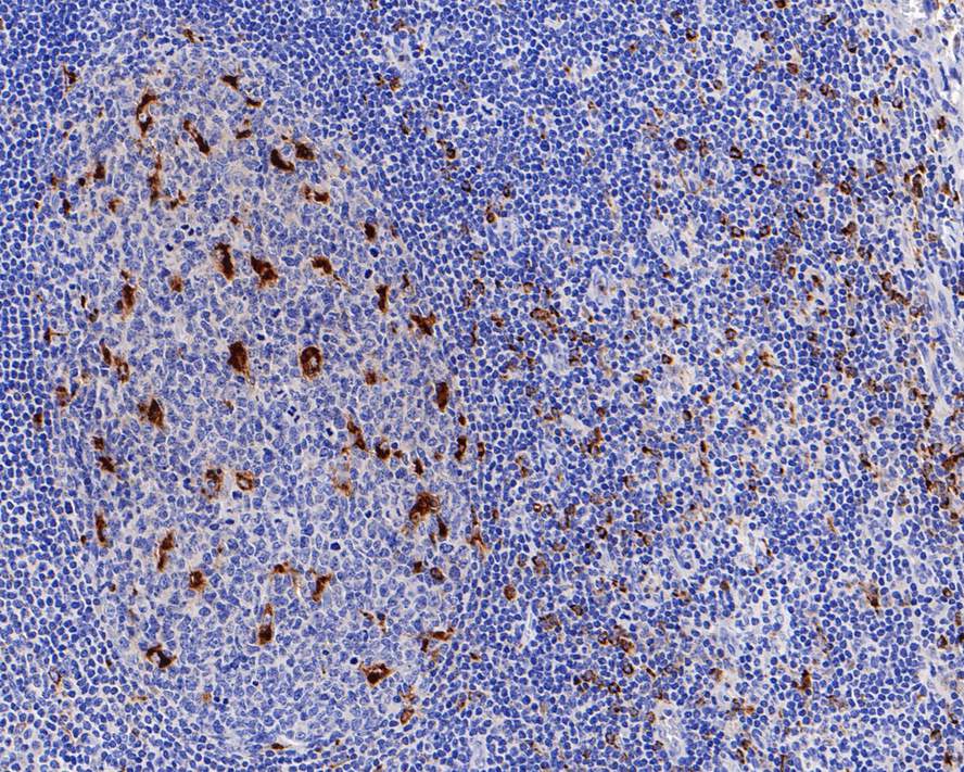 Immunohistochemical analysis of paraffin-embedded human tonsil tissue with Mouse anti-CD68 antibody (<a href="/products/HA601115" style="font-weight: bold;text-decoration: underline;">HA601115</a>) at 1/2,000 dilution.<br /><br />The section was pre-treated using heat mediated antigen retrieval with Tris-EDTA buffer (pH 9.0) for 20 minutes. The tissues were blocked in 1% BSA for 20 minutes at room temperature, washed with ddH<sub>2</sub>O and PBS, and then probed with the primary antibody (<a href="/products/HA601115" style="font-weight: bold;text-decoration: underline;">HA601115</a>) at 1/2,000 dilution for 1 hour at room temperature. The detection was performed using an HRP conjugated compact polymer system. DAB was used as the chromogen. Tissues were counterstained with hematoxylin and mounted with DPX.