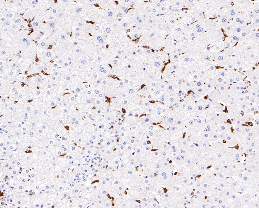Immunohistochemical analysis of paraffin-embedded human liver tissue with Mouse anti-CD68 antibody (<a href="/products/HA601115" style="font-weight: bold;text-decoration: underline;">HA601115</a>) at 1/4,000 dilution.<br /><br />The section was pre-treated using heat mediated antigen retrieval with Tris-EDTA buffer (pH 9.0) for 20 minutes. The tissues were blocked in 1% BSA for 20 minutes at room temperature, washed with ddH<sub>2</sub>O and PBS, and then probed with the primary antibody (<a href="/products/HA601115" style="font-weight: bold;text-decoration: underline;">HA601115</a>) at 1/4,000 dilution for 1 hour at room temperature. The detection was performed using an HRP conjugated compact polymer system. DAB was used as the chromogen. Tissues were counterstained with hematoxylin and mounted with DPX.