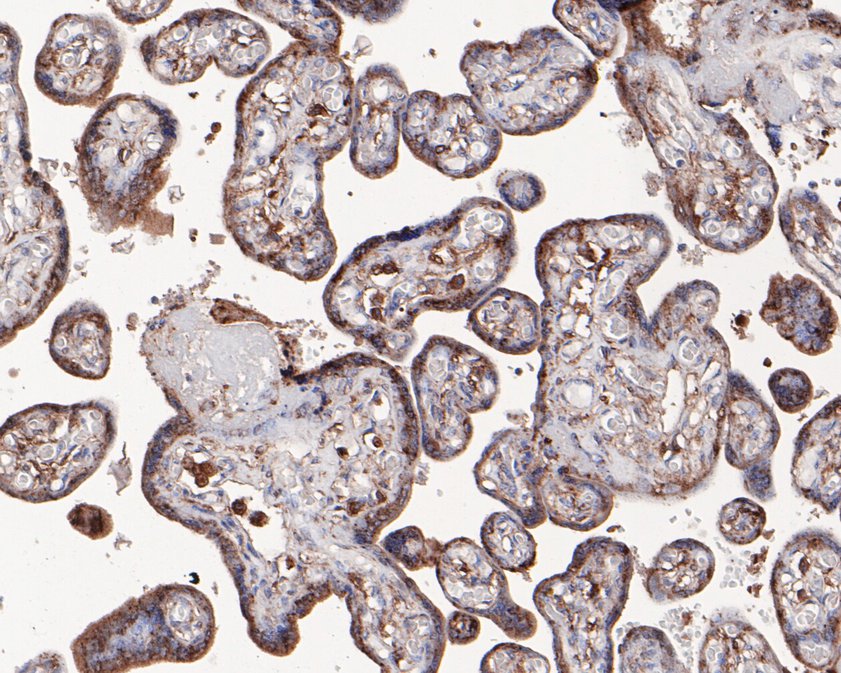 Immunohistochemical analysis of paraffin-embedded human placenta tissue using anti-Glucosidase 2 subunit beta antibody. The section was pre-treated using heat mediated antigen retrieval with Tris-EDTA buffer (pH 8.0-8.4) for 20 minutes.The tissues were blocked in 5% BSA for 30 minutes at room temperature, washed with ddH<sub>2</sub>O and PBS, and then probed with the primary antibody (<a href="/products/HA720042" style="font-weight: bold;text-decoration: underline;">HA720042</a>, 1/50) for 30 minutes at room temperature. The detection was performed using an HRP conjugated compact polymer system. DAB was used as the chromogen. Tissues were counterstained with hematoxylin and mounted with DPX.