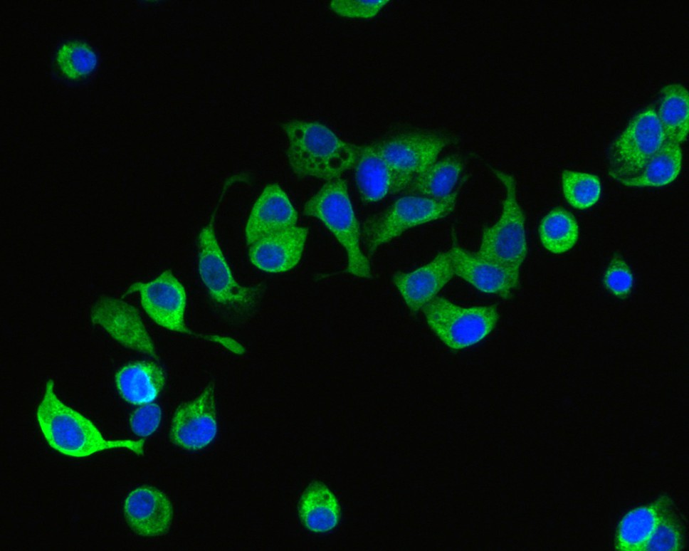 ICC staining of Glucosidase 2 subunit beta in MCF-7 cells (green). Formalin fixed cells were permeabilized with 0.1% Triton X-100 in TBS for 10 minutes at room temperature and blocked with 1% Blocker BSA for 15 minutes at room temperature. Cells were probed with the primary antibody (<a href="/products/HA720042" style="font-weight: bold;text-decoration: underline;">HA720042</a>, 1/200) for 1 hour at room temperature, washed with PBS. Alexa Fluor&reg;488 Goat anti-Rabbit IgG was used as the secondary antibody at 1/1,000 dilution. The nuclear counter stain is DAPI (blue).