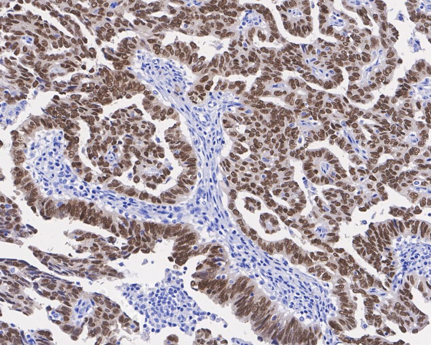 Immunohistochemical analysis of paraffin-embedded mouse thyroid tissue with Rabbit anti-PAX8 antibody (<a href="/products/HA720112" style="font-weight: bold;text-decoration: underline;">HA720112</a>) at 1/2,000 dilution.<br /><br />The section was pre-treated using heat mediated antigen retrieval with sodium citrate buffer (pH 6.0) for 2 minutes. The tissues were blocked in 1% BSA for 20 minutes at room temperature, washed with ddH<sub>2</sub>O and PBS, and then probed with the primary antibody (<a href="/products/HA720112" style="font-weight: bold;text-decoration: underline;">HA720112</a>) at 1/2,000 dilution for 1 hour at room temperature. The detection was performed using an HRP conjugated compact polymer system. DAB was used as the chromogen. Tissues were counterstained with hematoxylin and mounted with DPX.
