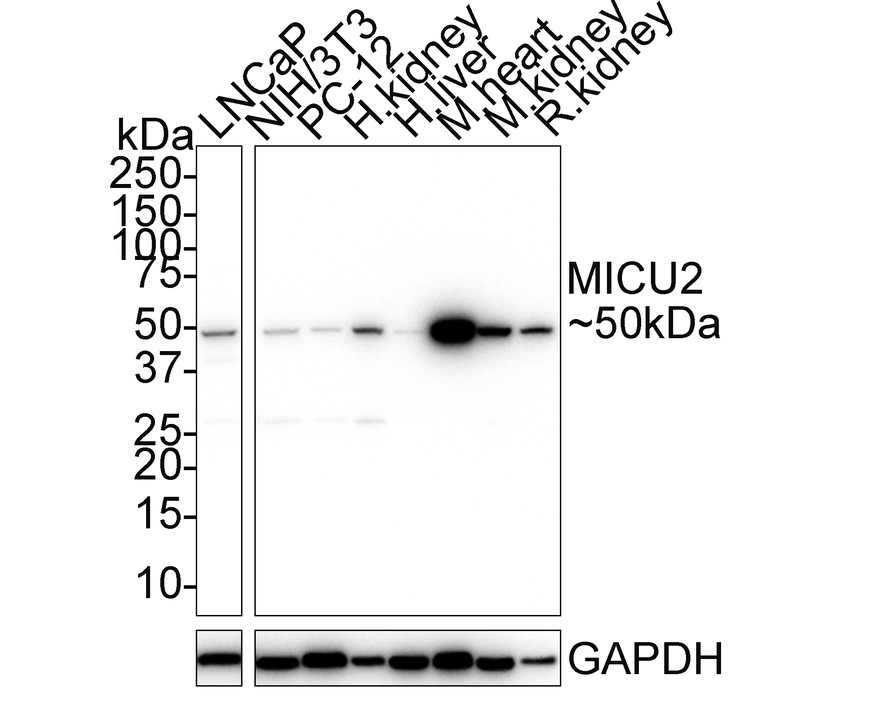 MICU2 Recombinant Rabbit Monoclonal Antibody [PSH01-84]