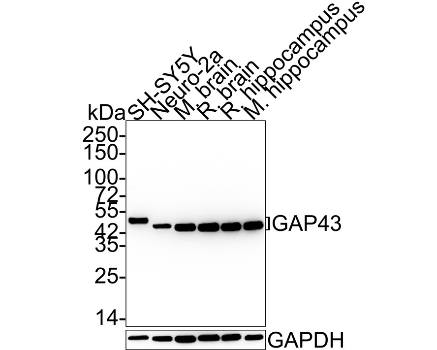 Western blot analysis of GAP43 on different lysates with Rabbit anti-GAP43 antibody (<a href="/products/ET1610-94" style="font-weight: bold;text-decoration: underline;">ET1610-94</a>) at 1/5,000 dilution.<br /><br />Lane 1: SH-SY5Y cell lysate<br />Lane 2: Neuro-2a cell lysate<br />Lane 3: Mouse brain tissue lysate<br />Lane 4: Rat brain tissue lysate<br />Lane 5: Rat hippocampus tissue lysate<br />Lane 6: Mouse hippocampus tissue lysate<br /><br />Lysates/proteins at 20 µg/Lane.<br /><br />Predicted band size: 25 kDa<br />Observed band size: 43/45 kDa<br /><br />Exposure time: 24 seconds;<br /><br />4-20% SDS-PAGE gel.<br /><br />Proteins were transferred to a PVDF membrane and blocked with 5% NFDM/TBST for 1 hour at room temperature. The primary antibody (<a href="/products/ET1610-94" style="font-weight: bold;text-decoration: underline;">ET1610-94</a>) at 1/5,000 dilution was used in 5% NFDM/TBST at 4℃ overnight. Goat Anti-Rabbit IgG - HRP Secondary Antibody (<a href="/products/HA1001" style="font-weight: bold;text-decoration: underline;">HA1001</a>) at 1:50,000 dilution was used for 1 hour at room temperature.