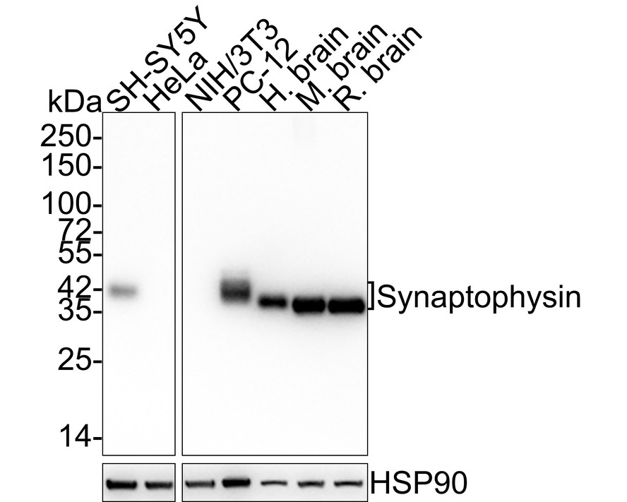 Western blot analysis of Synaptophysin on different lysates with Rabbit anti-Synaptophysin antibody (<a href="/products/ET1606-56" style="font-weight: bold;text-decoration: underline;">ET1606-56</a>) at 1/5,000 dilution.<br /><br />Lane 1: SH-SY5Y cell lysate<br />Lane 2: HeLa cell lysate (negative)<br />Lane 3: NIH/3T3 cell lysate (negative)<br />Lane 4: PC-12 cell lysate<br />Lane 5: Human brain tissue lysate<br />Lane 6: Mouse brain tissue lysate<br />Lane 7: Rat brain tissue lysate<br /><br />Lysates/proteins at 20 µg/Lane.<br /><br />Predicted band size: 34 kDa<br />Observed band size: 34/40 kDa<br /><br />Exposure time: 43 seconds;<br /><br />4-20% SDS-PAGE gel.<br /><br />Proteins were transferred to a PVDF membrane and blocked with 5% NFDM/TBST for 1 hour at room temperature. The primary antibody (<a href="/products/ET1606-56" style="font-weight: bold;text-decoration: underline;">ET1606-56</a>) at 1/5,000 dilution was used in 5% NFDM/TBST at 4℃ overnight. Goat Anti-Rabbit IgG - HRP Secondary Antibody (<a href="/products/HA1001" style="font-weight: bold;text-decoration: underline;">HA1001</a>) at 1:50,000 dilution was used for 1 hour at room temperature.